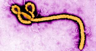 Virus ebola, pertama kali ditemukan di dekat sungai ebola di zaire (kongo) sekitar tahun 1976. Ebola Virus Symptoms Treatment And Prevention
