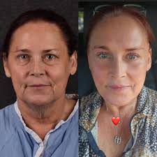 Dr. Sean Alemi, MD, FACS