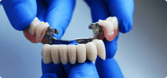 How many teeth can be on a bridge. Dental Bridges Thornhill Ontario Cost Estimates Book Appointment