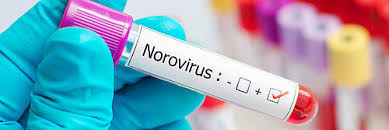 Norovirus is a fiercely contagious virus with a relatively short incubation period, says dr. Norovirus Symptome Behandlung Verlauf