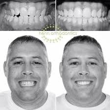 Henn Orthodontics Princeton, 901 S Main St, Princeton, IN 47670, US