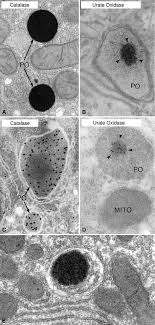 Check spelling or type a new query. The Peroxisome Still A Mysterious Organelle Springerlink