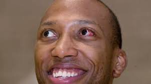 American basketball player OK after eye pops out of socket