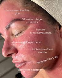 Unlock radiant skin with microneedling! ✨ Our newest service delivers  stunning results you won't want to miss—especially with our special intro  price! This quick, effective treatment boosts collagen, smooths texture,  and enhances