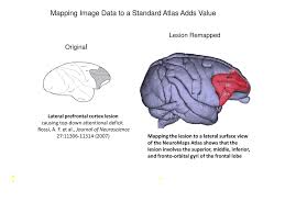 Through a simple and intuitive interface it is possible to observe every anatomical structure from any angle. Neuromaps Mapper The Mapper Is A Stand Alone Application For Mapping Data To Brain Atlases For Presentation And Publication Image Data Are Mapped To A Ppt Download