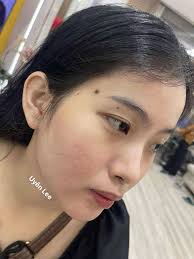 Thẩm Mỹ Uyên Lee Đà Nẵng
