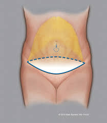 Image result for Umbilicus