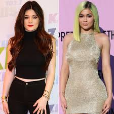 Barth, die mehr von ihrem körper zeigt. Kylie Jenner Ihre Unglaubliche Verwandlung In Bildern