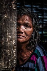 When Scars tell you a story "