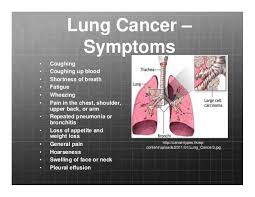 But there's no doubt that smoking is the largest risk. Chronic Pain