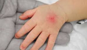 Maybe you would like to learn more about one of these? Heboh Challenge Selfie Bareng Kecoak Ini Lho Dampak Menyeramkan Yang Ada Di Baliknya Boombastis