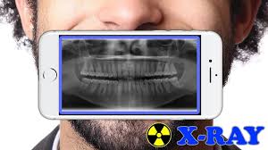 Bonus videos are meant to explain, expand or entertain. X Ray Filter Photo Latest Version For Android Download Apk