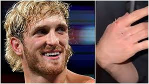 Boxing: Ouch! Logan Paul shares footage of the punch that broke his hand  and put his boxing career at risk