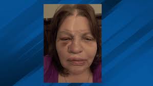 Irreparable, completely unnecessary:' Chattanooga woman wins millions after  doctor error