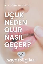 Ucuk Neden Olur Nasil Gecer Evde Yoga Ev Yapimi Cilt Bakimi Saglik