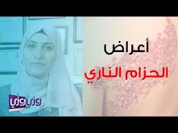 أعراض الحزام الناري وعلاجه Youtube
