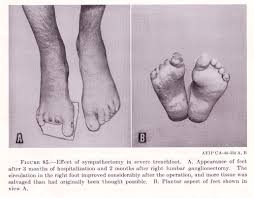Certain essential oils are antibacterial too which can get rid of the odor that sometimes accompanies athlete's foot. Office Of Medical History
