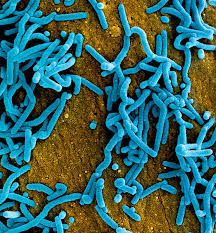Here are some facts about the marburg virus. Virus Virus Paling Mematikan Di Dunia Borneoscape