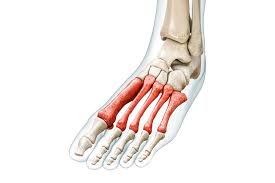 Image result for Metatarsal