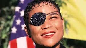 Singer Gabrielle considers wearing eyepatch again