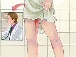 How To Treat Nausea And Diarrhea During Your Period Wikihow