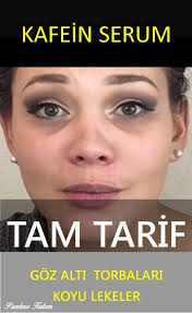 Goz Alti Torbalari Mor Halkalar Hepsi Tarih Artik Kafein Serum Tarifimle Siz De Gune Guzel Baslayin Gozaltit Cilt Bakimi Organik Cilt Bakimi Cilt Urunleri