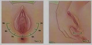 Tips tahan lama bercinta tanpa obat kuat sesuai anjuran dokter. Urut Faraj 12 Teknik Mudah Urut Ketika Hamil Untuk Elak Koyakan Theasianparent Malaysia