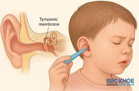 Hai trẻ em phải nhập viện do thói quen tưởng vô hại hàng ngày