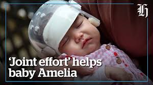 'Joint effort' helps baby Amelia