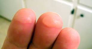 Know which finger to use in melodies and on chords. Ultimate Guide To Guitar Finger Pain Stop Sore Fingers Guitar Gear Finder