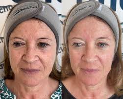 Ana Chamorro Estética Avanzada