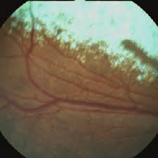 In today's vetgirl online veterinary ce video, we review a case of ivermectin toxicosis in a dog that responded well to treatment with intravenous lipid emulsion (e.g., ile). Pdf Ivermectin Induced Blindness Treated With Intravenous Lipid Therapy In A Dog