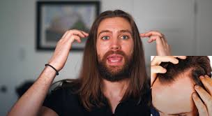 Hairstyles for receding hairline female first for women. Long Hair With A Receding Hairline Is It Even Receding