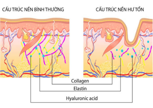 Sự khác biệt của collagen và elastin khi bị lão hóa