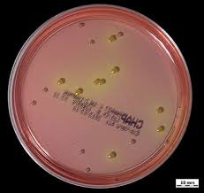 Blood agar base can be used for testing food samples as per the recommendation of apha. Why Differential Selective Media Remain Invaluable Tools