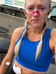 Overcoming obstacles through running