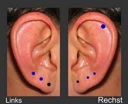 Heutzutage lassen sich sowohl männer als auch frauen ohrlöcher stechen. 5 Ohrlocher Aufeinmal Stechen Gesundheit Ohrloch