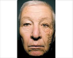 hugh winters (kopuru)