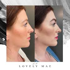 Lovely Mae Aesthetics