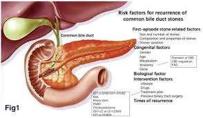 The biliary tract comprises of gallbladder and intra and extrahepatic biliary tree. Advances In Risk Factors For Recurrence Of Common Bile Duct Stones
