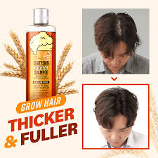 Brewer's yeast contains many vitamins, minerals and proteins that are indispensable for your hair. Amazon Com Crazy Skin Beers Shampoo 300g Ph 5 5 German Beer Yeast Scalp Care Hair Shampoo Shampoo For Thinning Hair And Hair Loss Rich In Biotin Protein Contained Paraben Free Beauty