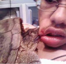 The best gifs are on giphy. When Turtles Attack Emergency Physicians Monthly