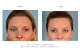 Center Aesthetic & Dermatology