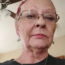 What are brown spots