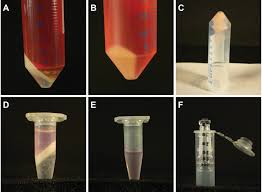 Image result for Gold 1995 AAV