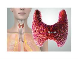 There are many different types of throat cancer. à®‡à®¨ à®¤ à®…à®± à®• à®± à®‡à®° à®¨ à®¤ à®¤à®² à®•à®´ à®¤ à®¤ à®² à®ª à®± à®± à®¨ à®¯ à®µà®°à®² à®® à®µà®¨ à®¤ à®‡à®µ à®³ à®¨ à®³ à®¤ à®© à®µ à®´ à®® à®Ÿ à®¯ à®® Immunotherapies To Treat Head And Neck Cancer Tamil Boldsky