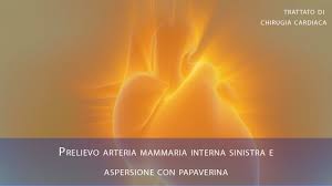Prelievo Arteria Mammaria Interna Sinistra E Aspersione Con Papaverina Youtube