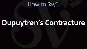 We did not find results for: How To Pronounce Dupuytren S Contracture Correctly Youtube