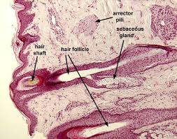 Image result for Sebaceous Gland
