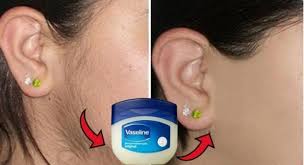 There Are So Many Ways You Can Use Vaseline For Example Mothers Use It To Prevent Diaper Rash Unwanted Hair Removal Unwanted Hair Unwanted Hair Permanently